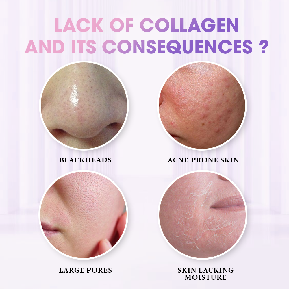 Collagen Jelly Mask
